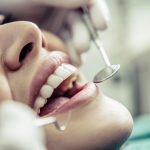 materiały stomatologiczne do wypełnień zęba